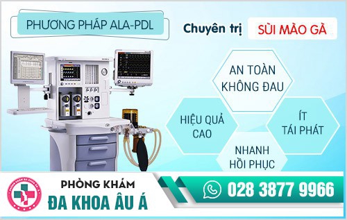tại sao bị sùi mào gà, vì sao bị sùi mào gà, lý do bị sùi mào gà